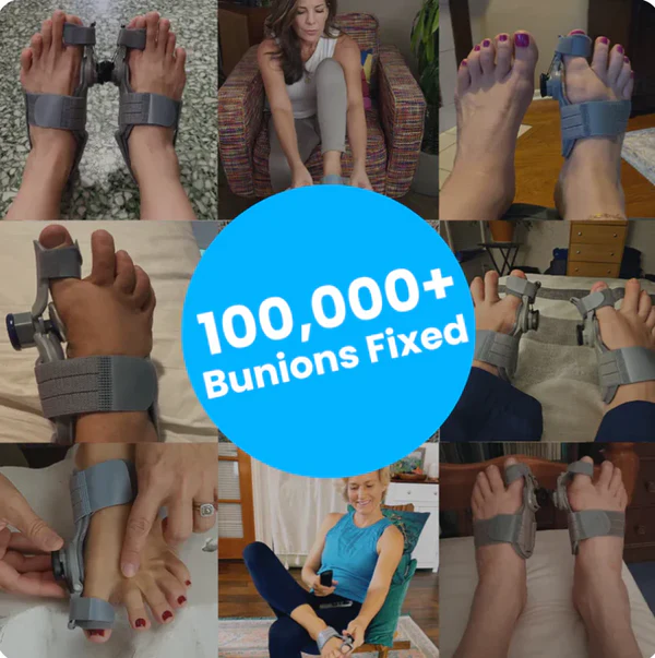 optilife™ bunion fix